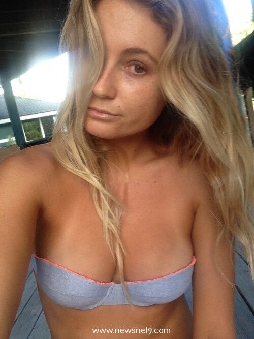 Alana Blanchard [surfista]