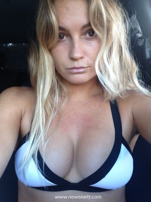 Alana Blanchard [surfista]