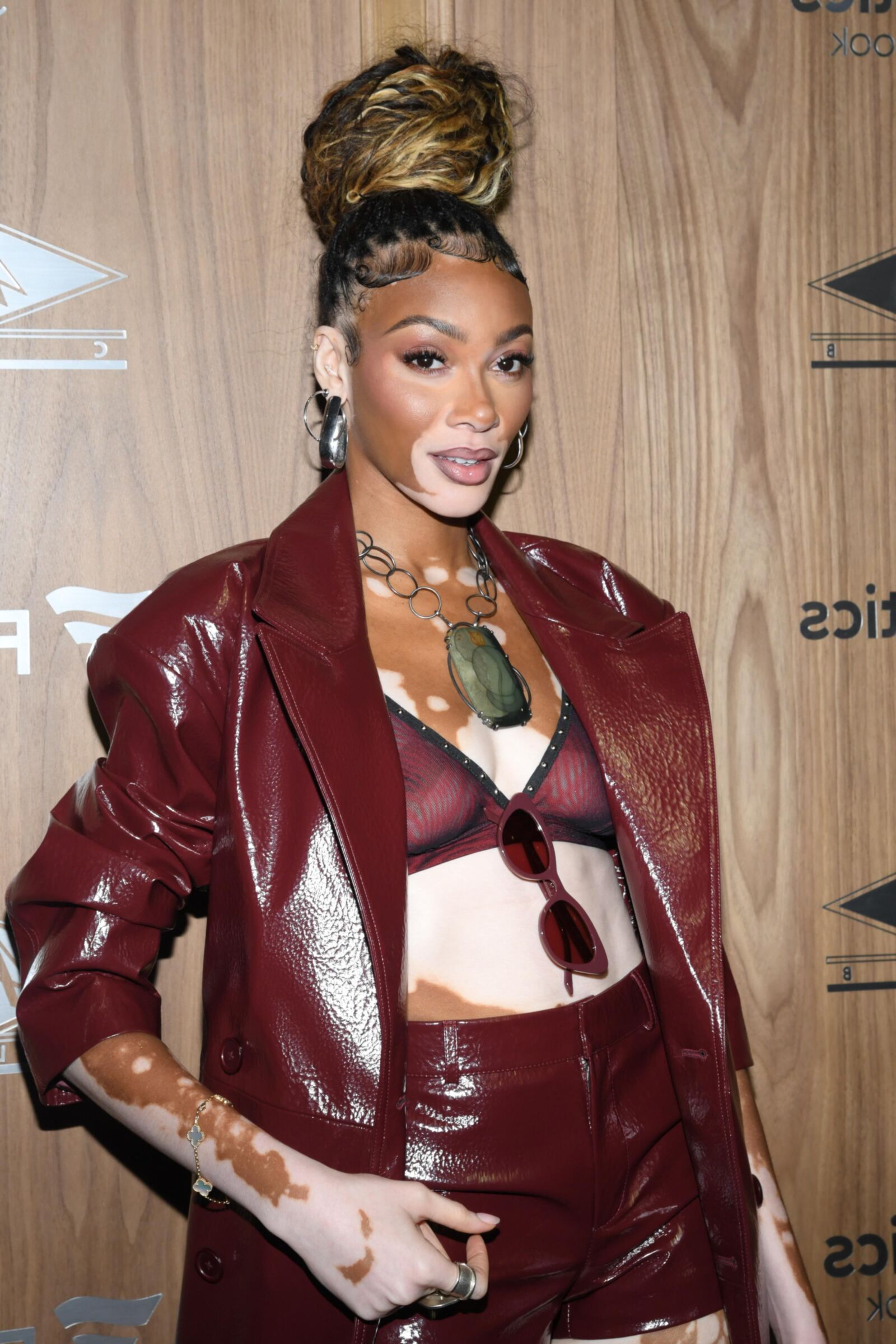 Winnie Harlow