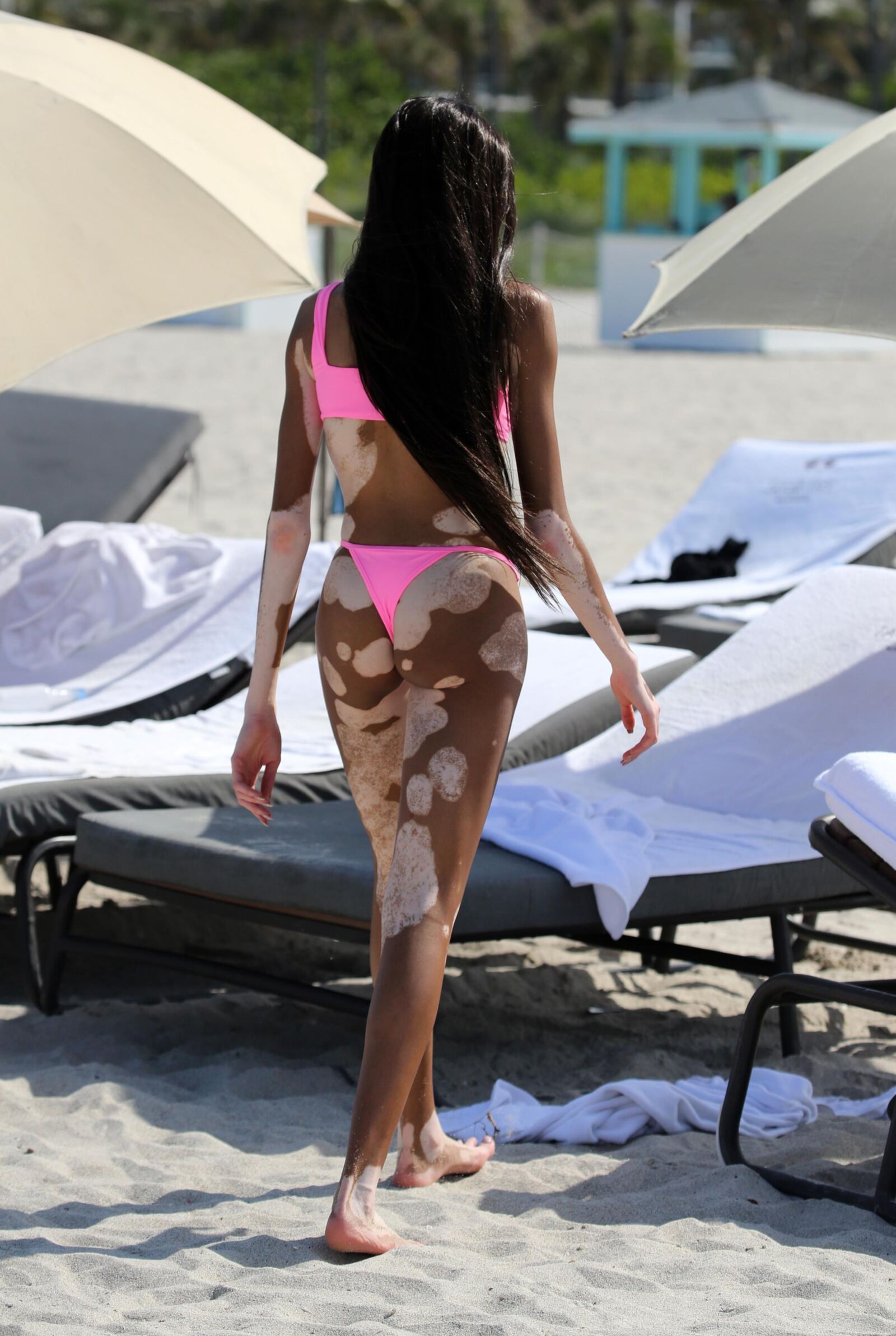 Winnie Harlow