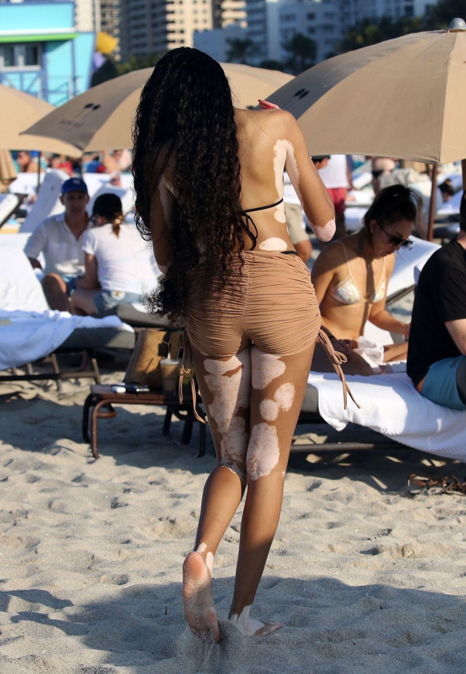 Winnie Harlow