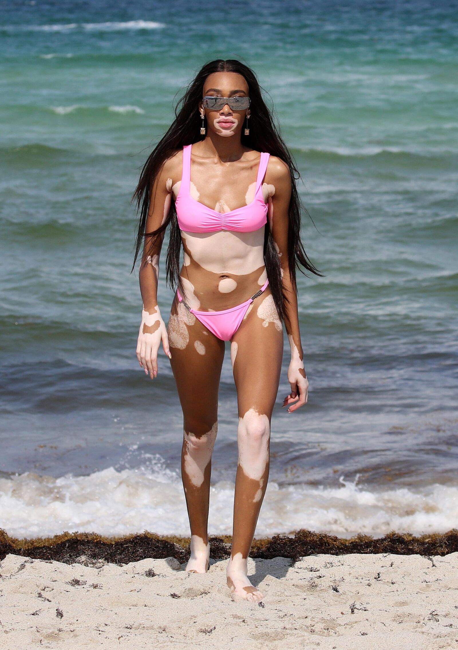 Winnie Harlow