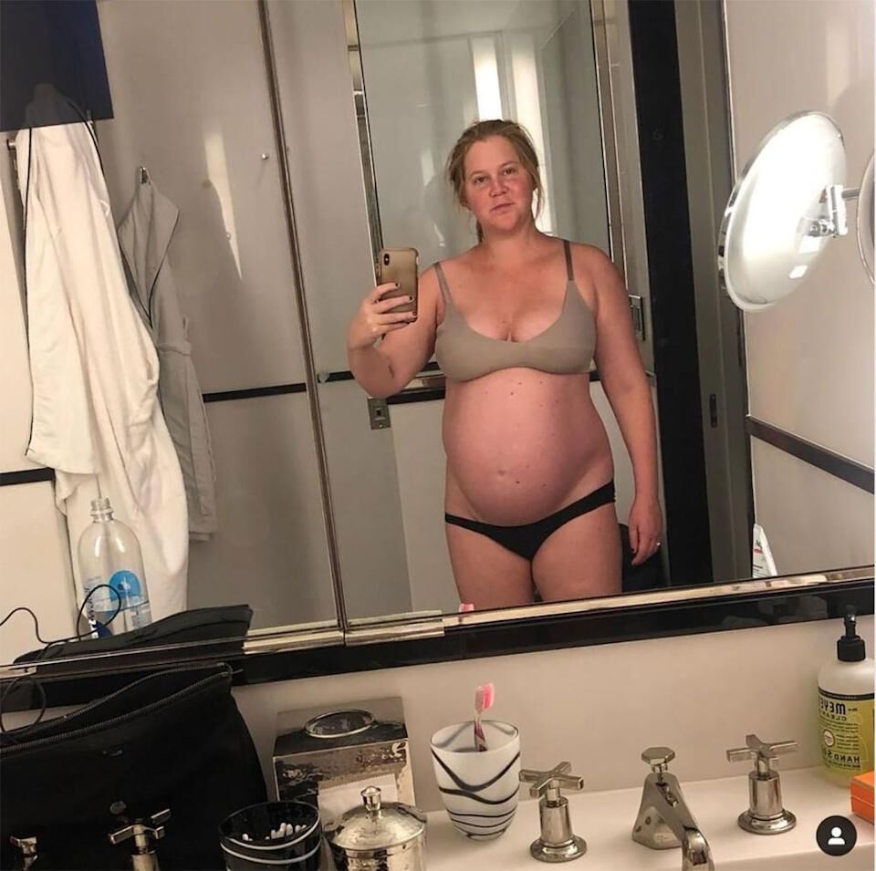 Amy schumer (actress)