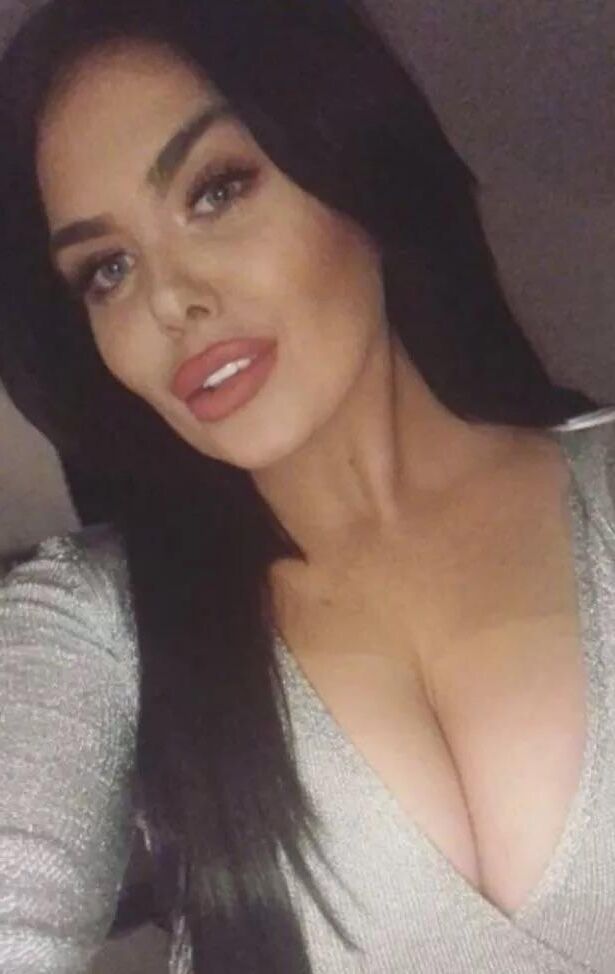 Scarlett moffatt ( TV personality)