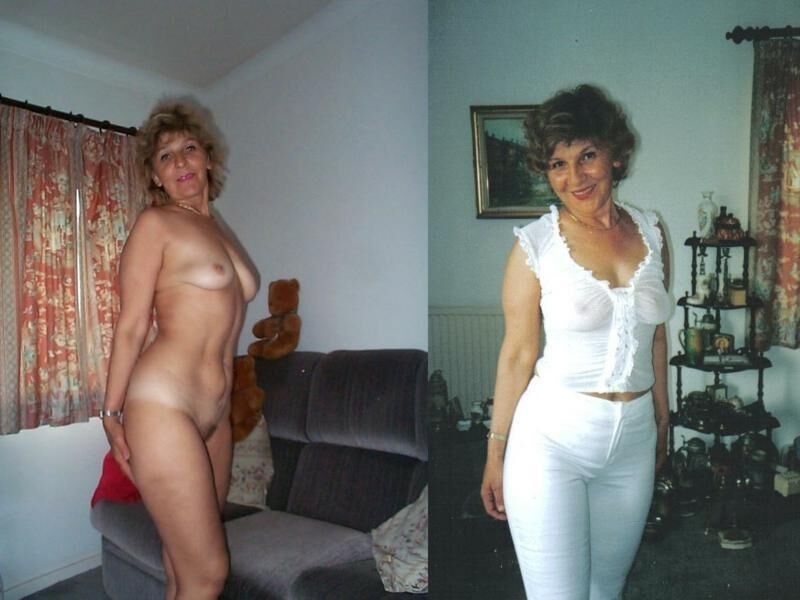 Before and After OMG 