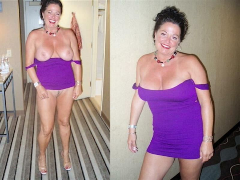 Before and After OMG 