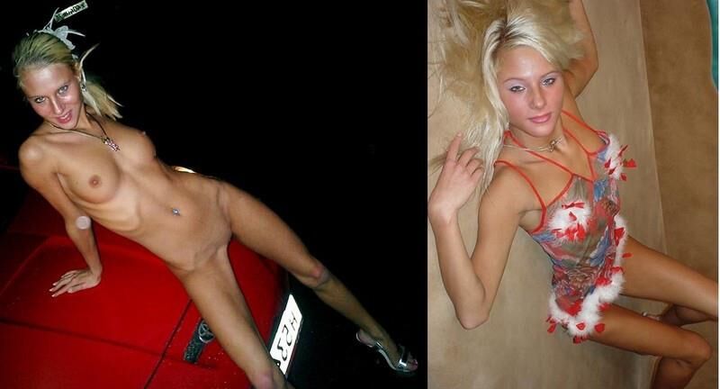 Before and After OMG 