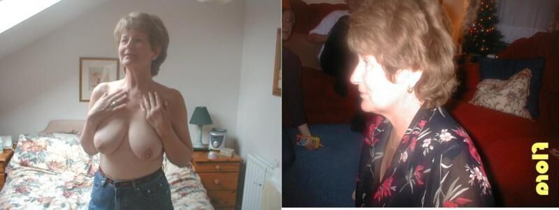 Before and After OMG 