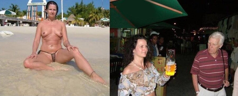 Before and After OMG 