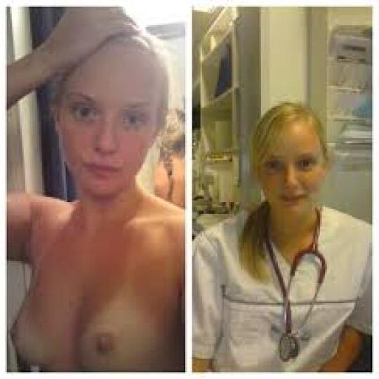 Before and After OMG 