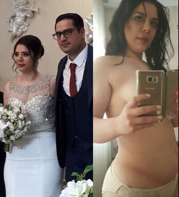 Before and After OMG 