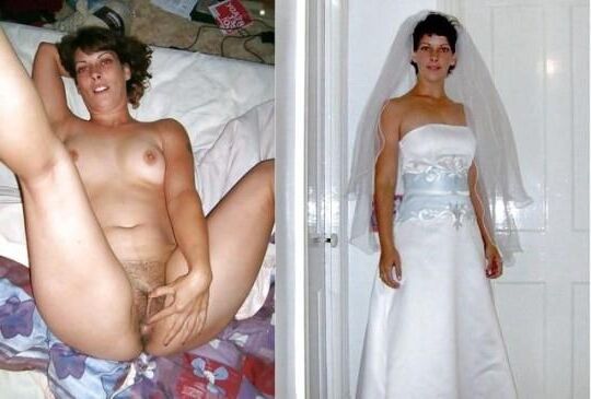 Before and After OMG 