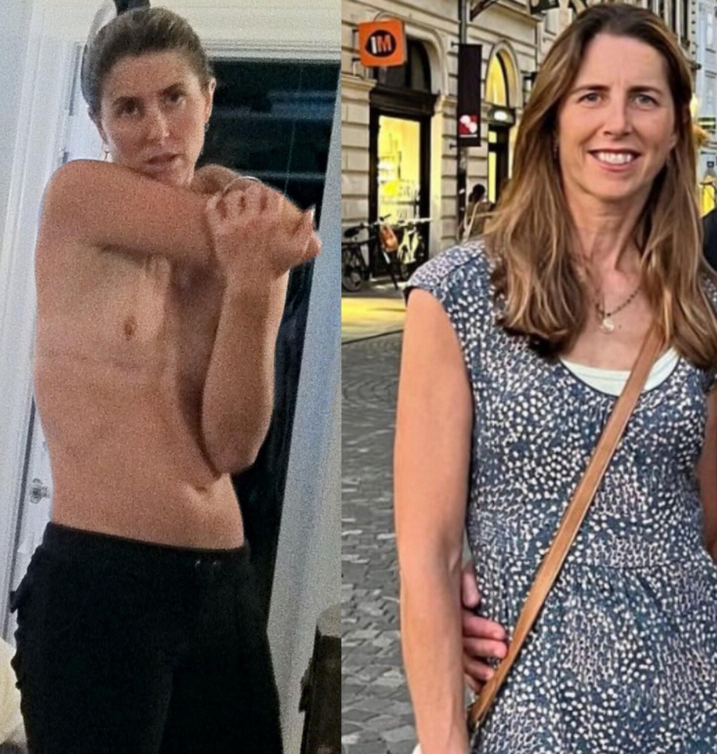 Before and After OMG 