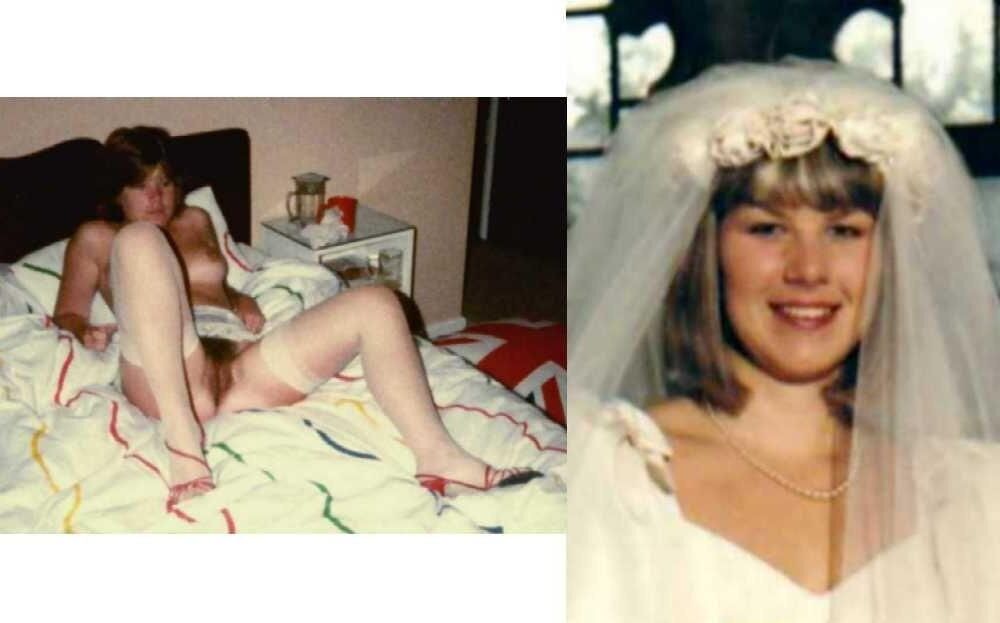 Before and After OMG 