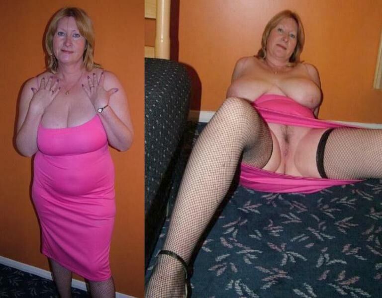 Before and After OMG 