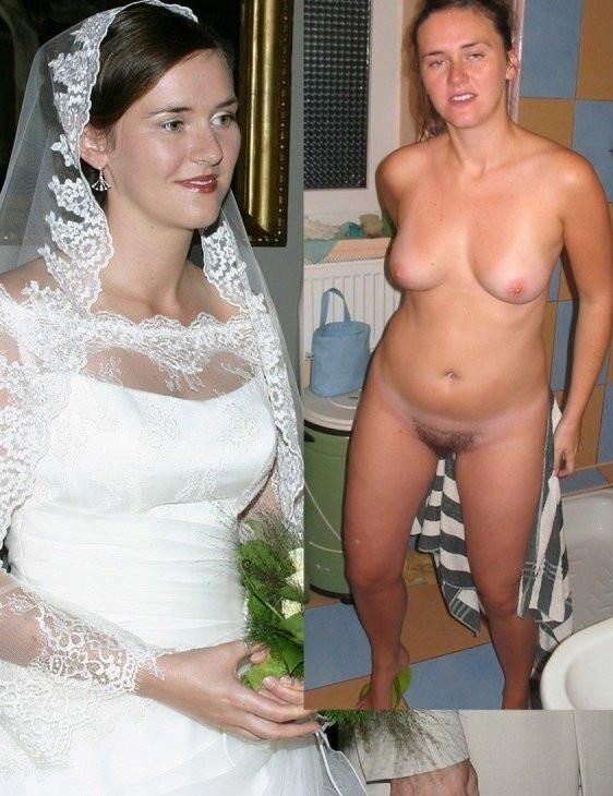Before and After OMG 
