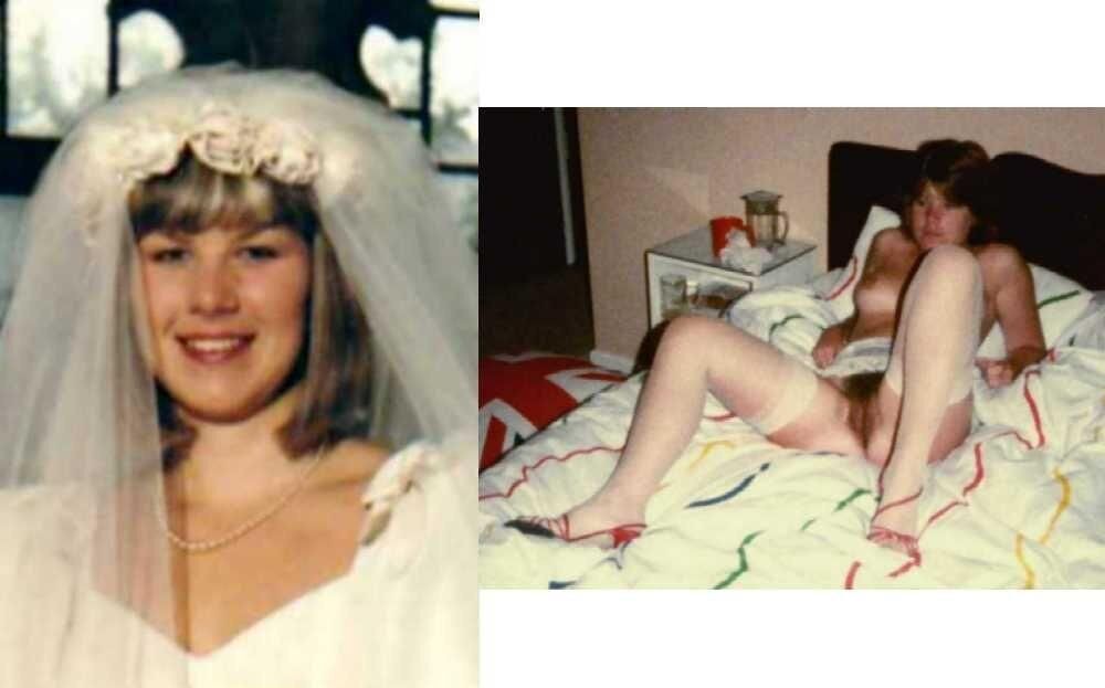 Before and After OMG 