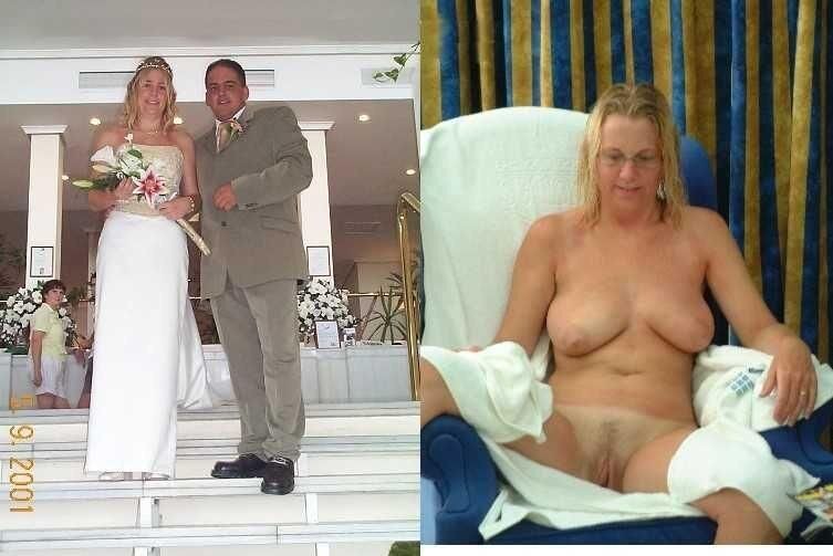 Before and After OMG 