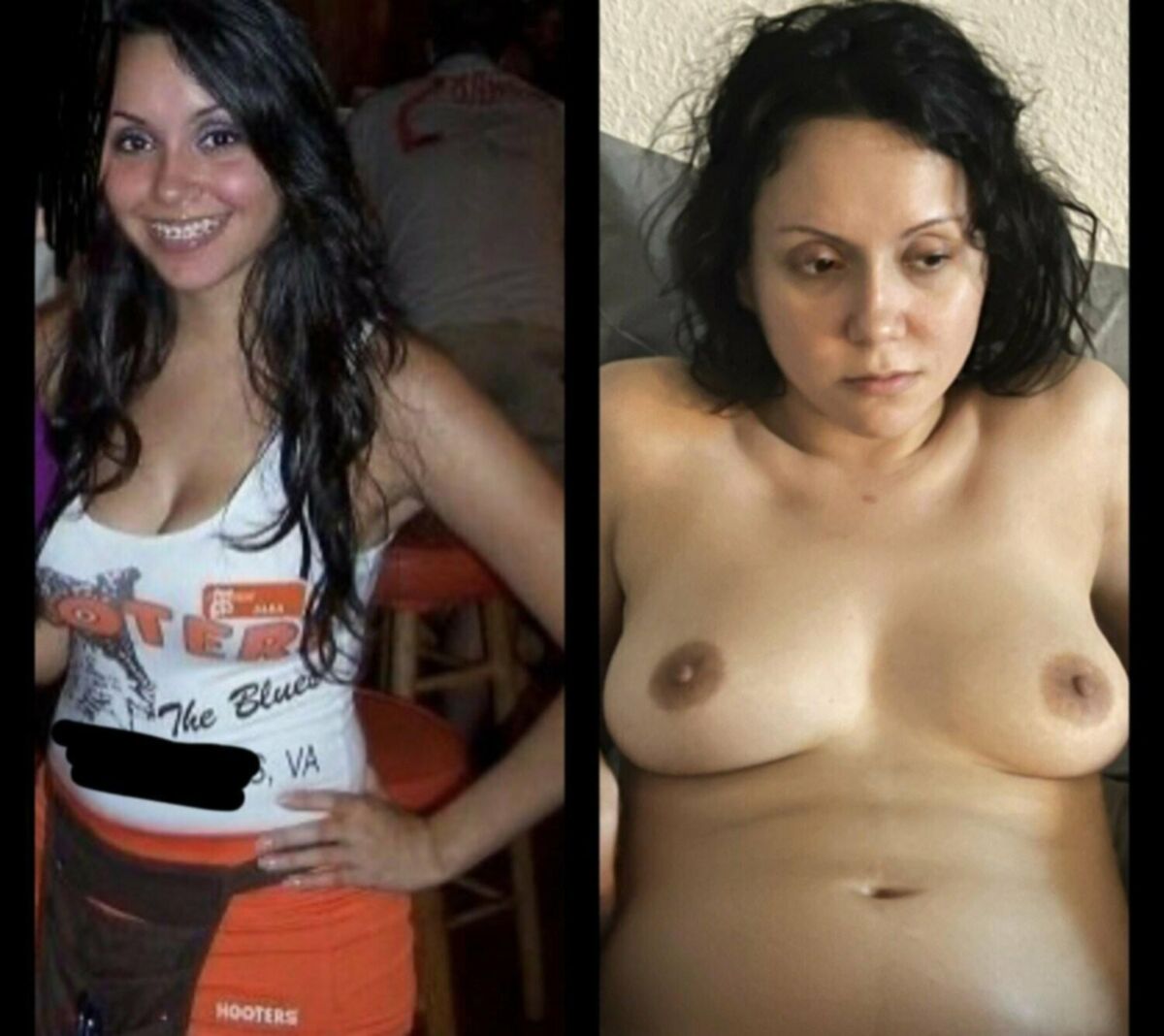 Before and After OMG 