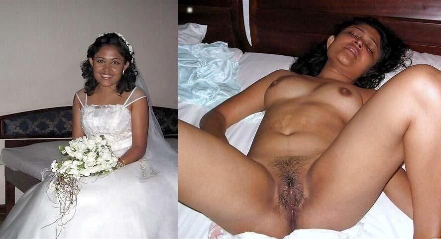 Before and After OMG 