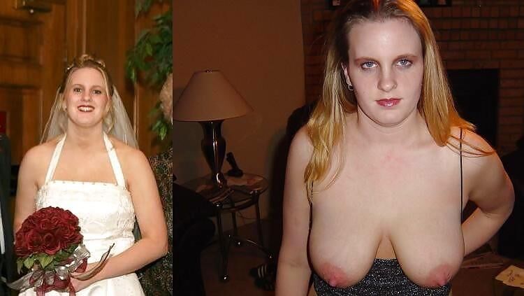 Before and After OMG 