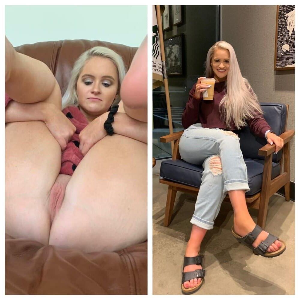 Before and After OMG 