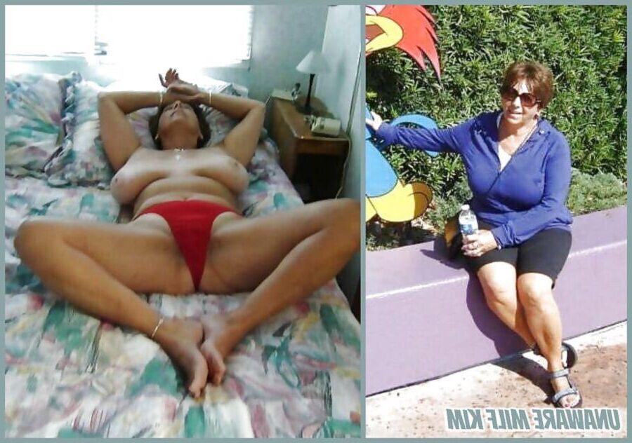 Before and After OMG 