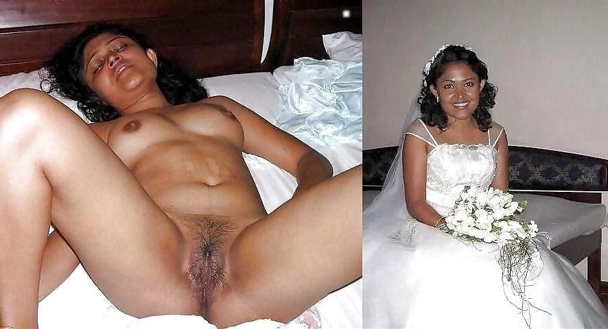 Before and After OMG 