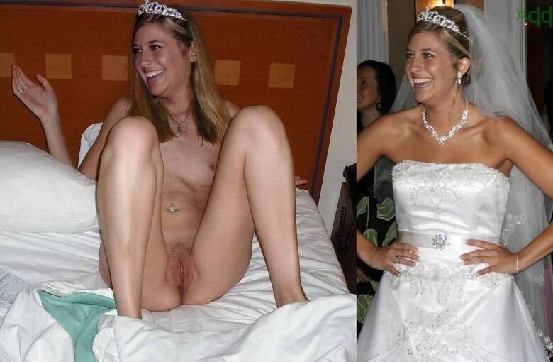 Before and After OMG 