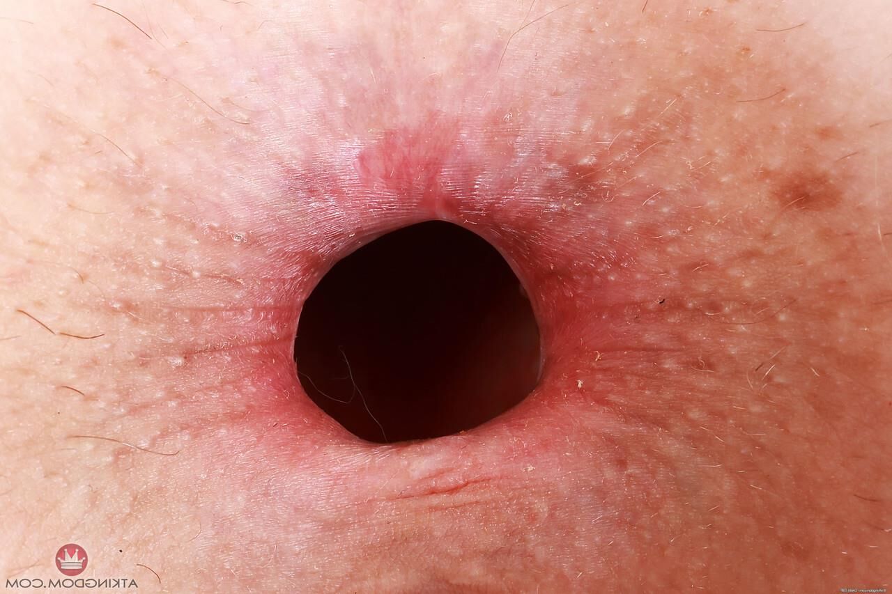 Gaping Holez