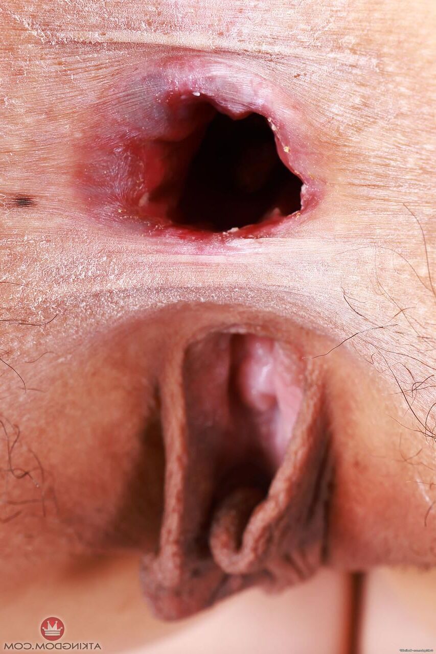 Gaping Holez
