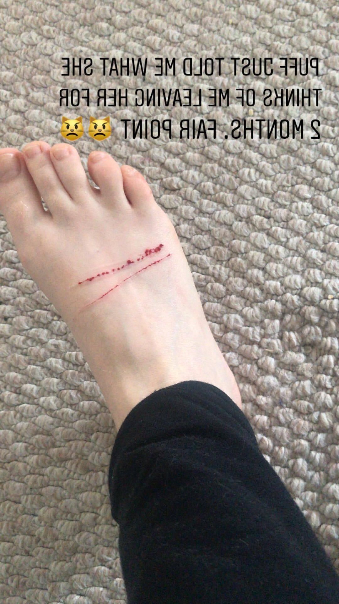 Evanna Lynch and her fantastic feet